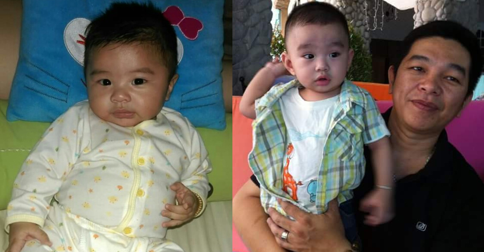 Chữa vẹo cổ trẻ sơ sinh hiệu quả bằng vật lý trị liệu Chữa vẹo cổ trẻ sơ sinh hiệu quả bằng vật lý trị liệu