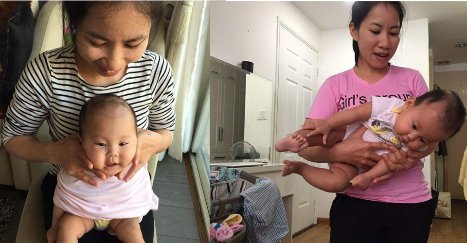 Vẹo cổ ở trẻ em chữa bằng vật lý trị liệu tập sớm nhanh khỏi Vẹo cổ ở trẻ em chữa bằng vật lý trị liệu tập sớm nhanh khỏi